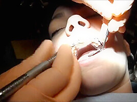 Braces Cleaning, dental fetish