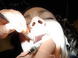 Braces Cleaning, dental fetish
