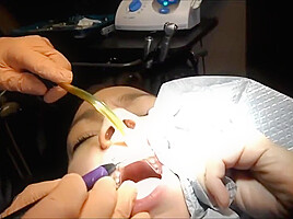 Braces Cleaning, dental fetish