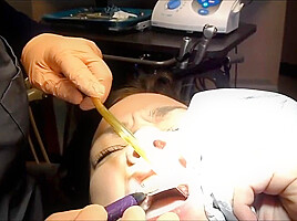 Braces Cleaning, dental fetish