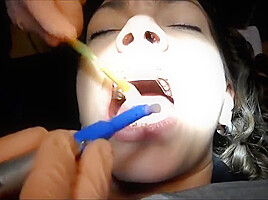 Braces Cleaning, dental fetish