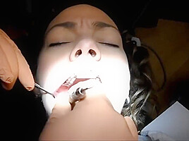 Braces Cleaning, dental fetish