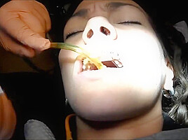 Braces Cleaning, dental fetish