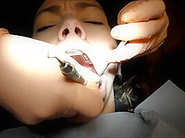 Braces Cleaning, dental fetish