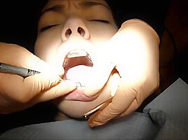 Braces Cleaning, dental fetish