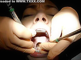 Braces Cleaning, dental fetish