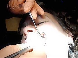 Braces Cleaning, dental fetish