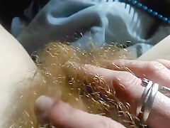 Hairy Redhead