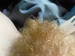 Hairy Redhead