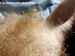 Hairy Redhead