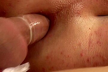 Lanny Sudden Anal Impact
