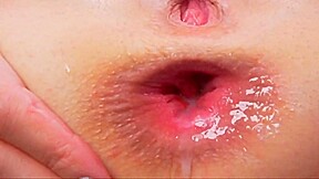 Love creampie anal cum ass college girl gape butt hole 01
