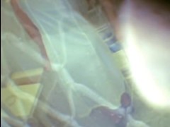 Medical scenes with unaware girl participation