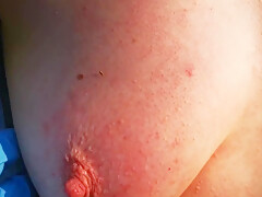 Nettle Torture My Breasts In Public Extreme – Try 2