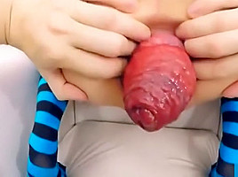 Prolapse Queen