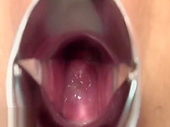 Pussy Collection Creampie Pussy