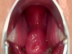 Pussy Collection Creampie Pussy