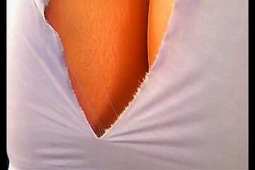 breast expansion